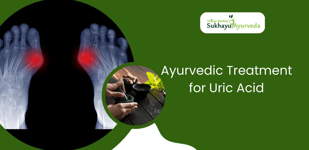 Ayurvedic Treatment For Uric Acid Sukhayu Ayurveda