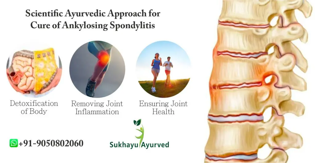 scientific ayurvedic approach for cure for ankylosing spondylitis