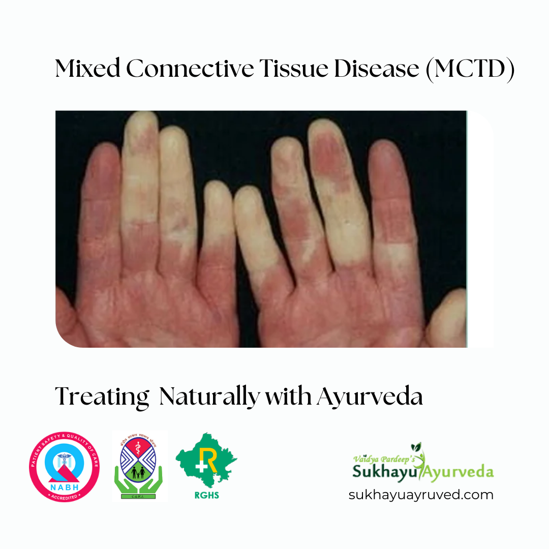 MCTD Ayurveda