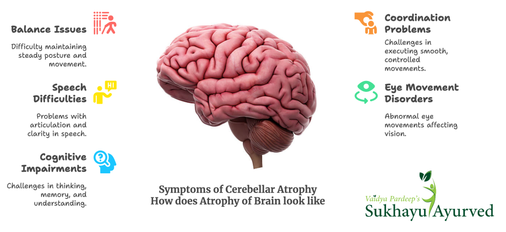 symptoms of cerebellar atrophy