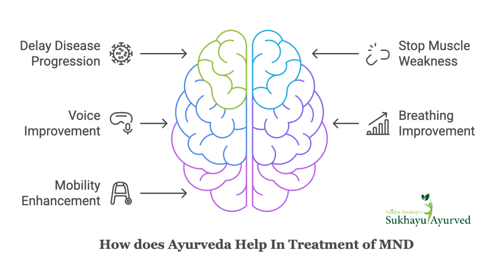 How Ayurveda treatment helps in treatment of MND